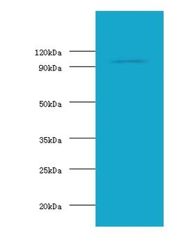 HK1 / Hexokinase 1 Antibody - Western blot of Hexokinase-1 antibody at 2 ug/ml with Rat brain tissue Secondary Goat polyclonal to Rabbit IgG at 1:15000 dilution. Predicted band size: 102 KDa. Observed band sized:102 KDa.  This image was taken for the unconjugated form of this product. Other forms have not been tested.