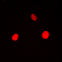 HK1 / Hexokinase 1 Antibody - Immunofluorescent analysis of Hexokinase 1 staining in HEK293T cells. Formalin-fixed cells were permeabilized with 0.1% Triton X-100 in TBS for 5-10 minutes and blocked with 3% BSA-PBS for 30 minutes at room temperature. Cells were probed with the primary antibody in 3% BSA-PBS and incubated overnight at 4 deg C in a humidified chamber. Cells were washed with PBST and incubated with a DyLight 594-conjugated secondary antibody (red) in PBS at room temperature in the dark. DAPI was used to stain the cell nuclei (blue).