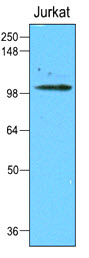 HK2 / Hexokinase 2 Antibody - Cell lysates of Jurkat (50 ug) were resolved by SDS-PAGE, transferred to NC membrane and probed with anti-human Hexokinase2 (1:2000). Proteins were visualized using a goat anti-mouse secondary antibody conjugated to HRP and an ECL detection.