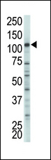 HK2 / Hexokinase 2 Antibody - The anti-HK2 antibody is used in Western blot to detect HK2 in A375 cell lysate.