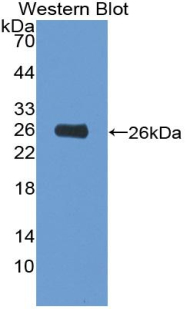 HK2 / Hexokinase 2 Antibody - Western blot of recombinant HK2 / Hexokinase 2.