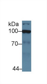 HK2 / Hexokinase 2 Antibody - Western Blot; Sample: Human Jurkat cell lysate; Primary Ab: 5µg/ml Rabbit Anti-Human HK2 Antibody Second Ab: 0.2µg/mL HRP-Linked Caprine Anti-Rabbit IgG Polyclonal Antibody