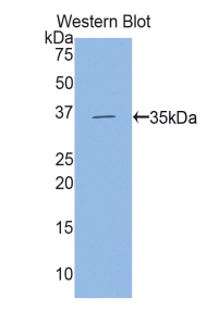 HK2 / Hexokinase 2 Antibody - Western blot of recombinant HK2 / Hexokinase 2.  This image was taken for the unconjugated form of this product. Other forms have not been tested.