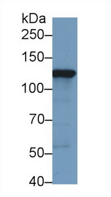 HK2 / Hexokinase 2 Antibody - Western Blot; Sample: Human HepG2 cell lysate; Primary Ab: 1µg/ml Rabbit Anti-Human HK2 Antibody Second Ab: 0.2µg/mL HRP-Linked Caprine Anti-Rabbit IgG Polyclonal Antibody