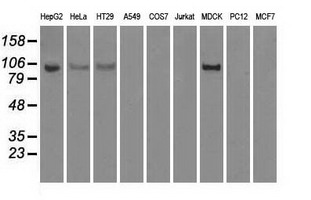 HK2 / Hexokinase 2 Antibody - Western blot of extracts (35 ug) from 9 different cell lines by using anti-HK2 monoclonal antibody.