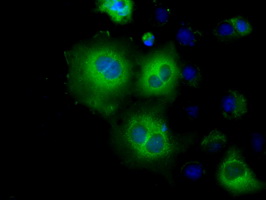 HK2 / Hexokinase 2 Antibody - Anti-HK2 mouse monoclonal antibody  immunofluorescent staining of COS7 cells transiently transfected by pCMV6-ENTRY HK2.