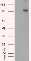 HK2 / Hexokinase 2 Antibody - HEK293T cells were transfected with the pCMV6-ENTRY control (Left lane) or pCMV6-ENTRY HK2 (Right lane) cDNA for 48 hrs and lysed. Equivalent amounts of cell lysates (5 ug per lane) were separated by SDS-PAGE and immunoblotted with anti-HK2.