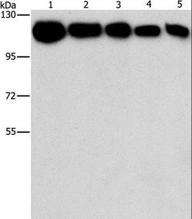 HK2 / Hexokinase 2 Antibody - Western blot analysis of A431, K562, 231, HeLa and hepG2 cell, using HK2 Polyclonal Antibody at dilution of 1:1200.