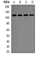HK2 / Hexokinase 2 Antibody - Western blot analysis of Hexokinase 2 expression in SHSY5Y (A); MCF7 (B); K562 (C); COS7 (D) whole cell lysates.