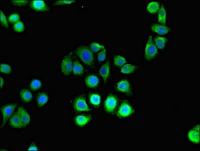 HK2 / Hexokinase 2 Antibody - Immunofluorescent analysis of PC3 cells diluted at 1:100 and Alexa Fluor 488-congugated AffiniPure Goat Anti-Rabbit IgG(H+L)