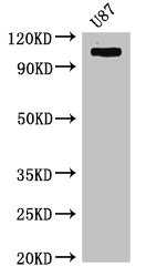 HK2 / Hexokinase 2 Antibody - Western Blot Positive WB detected in:U87 whole cell lysate All Lanes:HK2 antibody at 4µg/ml Secondary Goat polyclonal to rabbit IgG at 1/50000 dilution Predicted band size: 103 kDa Observed band size: 103 kDa