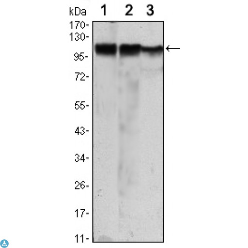 HK2 / Hexokinase 2 Antibody - Western Blot (WB) analysis using HXK II Monoclonal Antibody against Jurkat (1), HeLa (2) and HEK293 (3) cell lysate.