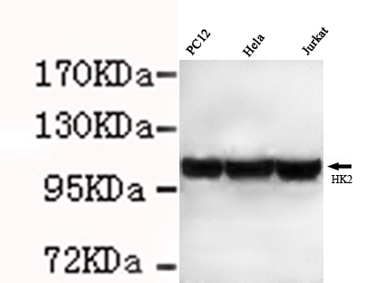HK2 / Hexokinase 2 Antibody - HK2 (N-terminus) antibody at 1/3000 dilution Lane1: PC12 cell lysate 40 ug/Lane Lane2: HeLa cell lysate 40 ug/Lane Lane3: Jurkat cell lysate 40 ug/Lane Predicted band size: 102KDa Observed.