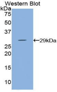 HK3 / Hexokinase 3 Antibody - Western blot of recombinant HK3 / Hexokinase 3.