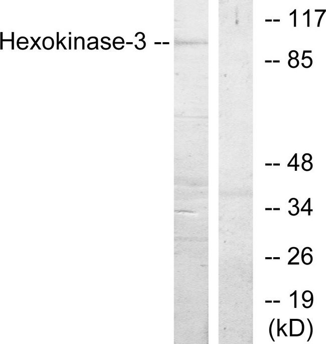 HK3 / Hexokinase 3 Antibody - Western blot analysis of lysates from Jurkat cells, treated with insulin 0.01U/ml 15', using Hexokinase-3 Antibody. The lane on the right is blocked with the synthesized peptide.