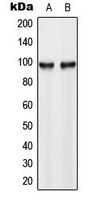 HK3 / Hexokinase 3 Antibody - Western blot analysis of Hexokinase 3 expression in HL60 (A); HeLa (B) whole cell lysates.