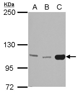 HK3 / Hexokinase 3 Antibody - Sample (30 ug of whole cell lysate) A: 293T B: A431 C: HeLa 5% SDS PAGE HK3 / Hexokinase 3 antibody diluted at 1:3000