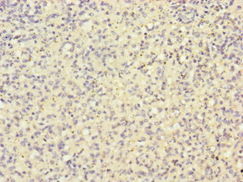 HK3 / Hexokinase 3 Antibody - Immunohistochemistry of paraffin-embedded human spleen tissue at dilution of 1:100