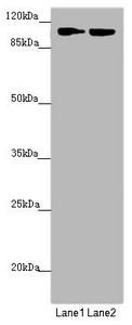 HK3 / Hexokinase 3 Antibody - Western blot All Lanes:HK3 antibody at 1.47 ug/ml Lane 1: Mouse liver tissue Lane 2: Mouse kidney tissue Secondary Goat polyclonal to rabbit IgG at 1/10000 dilution Predicted band size: 99 kDa Observed band size: 99 kDa