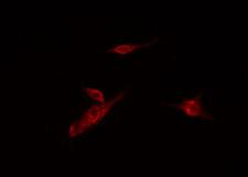 HK3 / Hexokinase 3 Antibody - Staining HeLa cells by IF/ICC. The samples were fixed with PFA and permeabilized in 0.1% Triton X-100, then blocked in 10% serum for 45 min at 25°C. The primary antibody was diluted at 1:200 and incubated with the sample for 1 hour at 37°C. An Alexa Fluor 594 conjugated goat anti-rabbit IgG (H+L) antibody, diluted at 1/600, was used as secondary antibody.