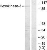 HK3 / Hexokinase 3 Antibody - Western blot analysis of extracts from Jurkat cells, treated with insulin (0.01U/ml, 15mins), using Hexokinase-3 antibody.