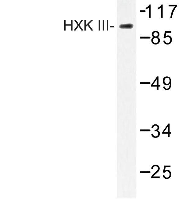HK3 / Hexokinase 3 Antibody - Western blot of HXK III (V848) pAb in extracts from Jurkat insulin 0.01U cells.