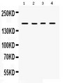 HKDC1 Antibody - H kDC1 antibody Western blot. All lanes: Anti H kDC1 at 0.5 ug/ml. Lane 1: 293T Whole Cell Lysate at 40 ug. Lane 2: SW620 Whole Cell Lysate at 40 ug. Lane 3: COLO320 Whole Cell Lysate at 40 ug. Lane 4: HELA Whole Cell Lysate at 40 ug. Predicted band size: 103 kD. Observed band size: 170 kD.