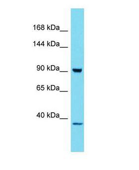 HKDC1 Antibody - Western blot of HKDC1 Antibody - C-terminal region with human 293T cells lysate.  This image was taken for the unconjugated form of this product. Other forms have not been tested.