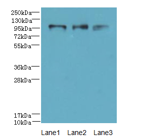 HKDC1 Antibody - Western blot. All lanes: HKDC1 antibody at 4 ug/ml. Lane 1: U87 whole cell lysate. Lane 2: Caco-2 whole cell lysate. Lane 3: PC-3 whole cell lysate. Secondary Goat polyclonal to Rabbit IgG at 1:10000 dilution. Predicted band size: 103 kDa. Observed band size: 103 kDa.