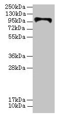HKDC1 Antibody - Western blot All lanes: HKDC1 antibody at 4µg/ml Lane 1: U87 whole cell lysate Lane 2: Caco-2 whole cell lysate Lane 3: PC-3 whole cell lysate Secondary Goat polyclonal to rabbit IgG at 1/10000 dilution Predicted band size: 103, 91, 83 kDa Observed band size: 103 kDa