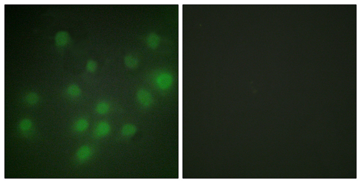 HKR1 Antibody - Immunofluorescence analysis of HUVEC cells, using HKR1 Antibody. The picture on the right is blocked with the synthesized peptide.
