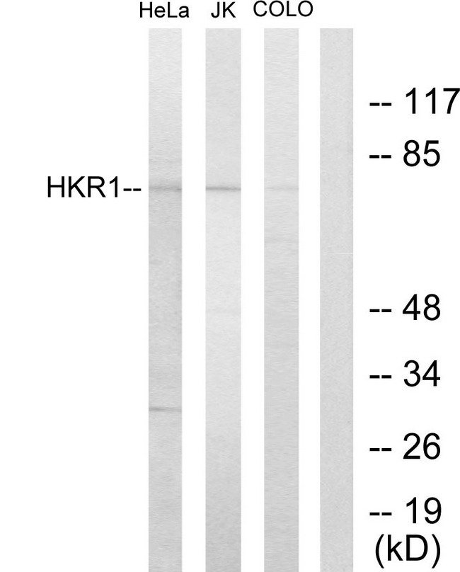 HKR1 Antibody - Western blot analysis of lysates from HeLa, Jurkat, and COLO205 cells, using HKR1 Antibody. The lane on the right is blocked with the synthesized peptide.
