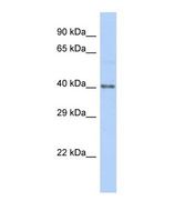 HKR1 Antibody - Western blot of Human HeLa. HKR1 antibody dilution 1.0 ug/ml.  This image was taken for the unconjugated form of this product. Other forms have not been tested.