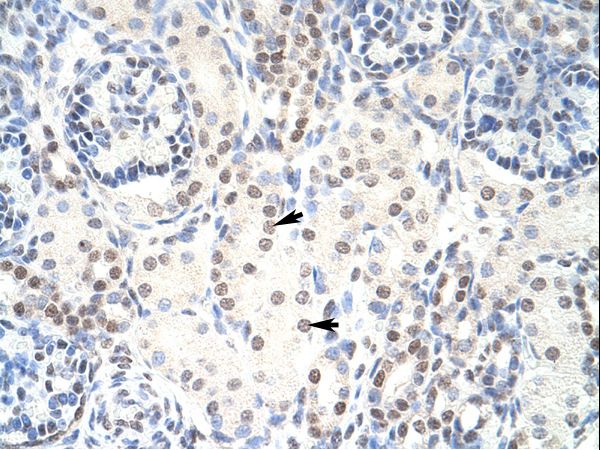 HKR1 Antibody - HKR1 antibody ARP40041_P050-NP_861451-HKR1 (GLI-Kruppel family member HKR1) Antibody was used in IHC to stain formalin-fixed, paraffin-embedded human kidney.  This image was taken for the unconjugated form of this product. Other forms have not been tested.