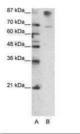HKR1 Antibody - B: HepG2 Cell Lysate.  This image was taken for the unconjugated form of this product. Other forms have not been tested.