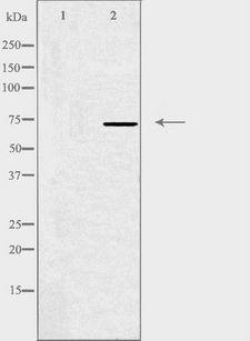 HKR1 Antibody - Western blot analysis of extracts of HeLa cells using HKR1 antibody.