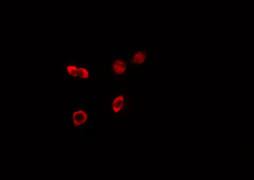 HKR1 Antibody - Staining HeLa cells by IF/ICC. The samples were fixed with PFA and permeabilized in 0.1% Triton X-100, then blocked in 10% serum for 45 min at 25°C. The primary antibody was diluted at 1:200 and incubated with the sample for 1 hour at 37°C. An Alexa Fluor 594 conjugated goat anti-rabbit IgG (H+L) antibody, diluted at 1/600, was used as secondary antibody.