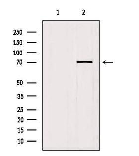 HKR1 Antibody - Western blot analysis of extracts of mouse brain tissue using HKR1 antibody. Lane 1 was treated with the blocking peptide.