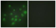 HKR1 Antibody - Peptide - + Immunofluorescence analysis of HUVEC cells, using HKR1 antibody.