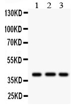 HLA-A Antibody - HLA-A antibody Western blot. All lanes: Anti HLA-A at 0.5 ug/ml. Lane 1: U87 Whole Cell Lysate at 40 ug. Lane 2: HEPG2 Whole Cell Lysate at 40 ug. Lane 3: Mouse Brain Tissue Lysate at 50 ug. Predicted band size: 41 kD. Observed band size: 41 kD.