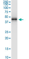 HLA-A Antibody - HLA-A monoclonal antibody (M01), clone 2D6. Western Blot analysis of HLA-A expression in A-431.