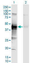 HLA-A Antibody - Western Blot analysis of HLA-A expression in transfected 293T cell line by HLA-A monoclonal antibody (M01), clone 2D6.Lane 1: HLA-A transfected lysate (Predicted MW: 40.8 KDa).Lane 2: Non-transfected lysate.