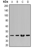 HLA-A Antibody - Western blot analysis of HLA-A expression in HeLa (A); SW480 (B); HepG2 (C); mouse liver (D) whole cell lysates.