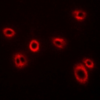 HLA-A Antibody - Immunofluorescent analysis of HLA-A staining in U2OS cells. Formalin-fixed cells were permeabilized with 0.1% Triton X-100 in TBS for 5-10 minutes and blocked with 3% BSA-PBS for 30 minutes at room temperature. Cells were probed with the primary antibody in 3% BSA-PBS and incubated overnight at 4 deg C in a humidified chamber. Cells were washed with PBST and incubated with a DyLight 594-conjugated secondary antibody (red) in PBS at room temperature in the dark.