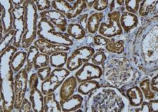 HLA-A Antibody - 1:100 staining rat kidney tissue by IHC-P. The sample was formaldehyde fixed and a heat mediated antigen retrieval step in citrate buffer was performed. The sample was then blocked and incubated with the antibody for 1.5 hours at 22°C. An HRP conjugated goat anti-rabbit antibody was used as the secondary.