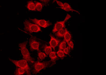 HLA-A Antibody - Staining HepG2 cells by IF/ICC. The samples were fixed with PFA and permeabilized in 0.1% Triton X-100, then blocked in 10% serum for 45 min at 25°C. The primary antibody was diluted at 1:200 and incubated with the sample for 1 hour at 37°C. An Alexa Fluor 594 conjugated goat anti-rabbit IgG (H+L) Ab, diluted at 1/600, was used as the secondary antibody.