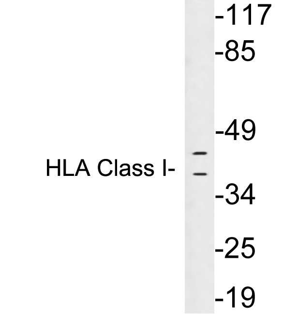 HLA-A/B/C Antibody - Western blot analysis of lysates from Ramos cells, using HLA Class I antibody.