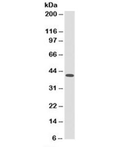 HLA-A/B/C Antibody - Western blot testing of ThP-1 cell lysate with HLA-ABC antibody. Expected molecular weight of A/B/C: 40-41kDa. This image was taken for the unmodified form of this product. Other forms have not been tested.