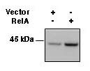 HLA-A/B/C Antibody - HEK293 cells were transfected with RelA or empty vector and 24hrs later cell extracts harvested using a 1% CHAPS lysis buffer. Extracts were resolved by non-denaturing, non-reducing electrophoresis, transferred to nitrocellulose, and probed with a 1:500 d