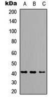 HLA-A/B/C Antibody - Western blot analysis of HLA-A/B/C expression in A549 (A); NS-1 (B); H9C2 (C) whole cell lysates.